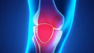 JOHN GALLUCCI: IS IT OSGOOD-SCHLATTER’S DISEASE?